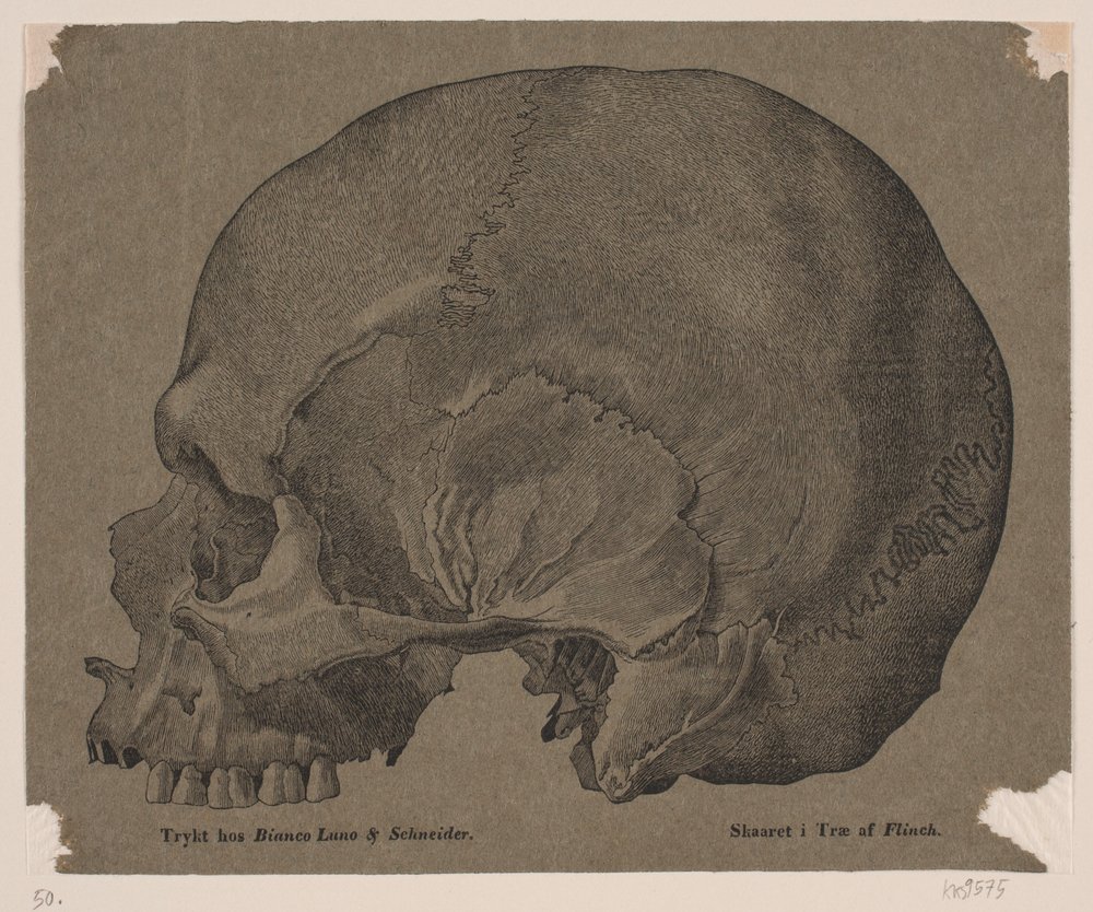 Crânio de Andreas Flinch