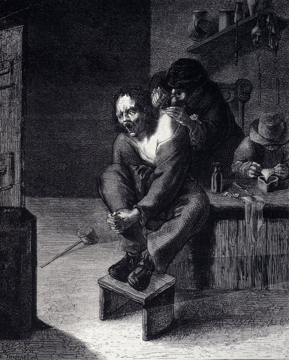 A operação cirúrgica Gravura após uma pintura de Adrien Brauwer (fez 1608) Século XVII de Adriaen (after) Brouwer