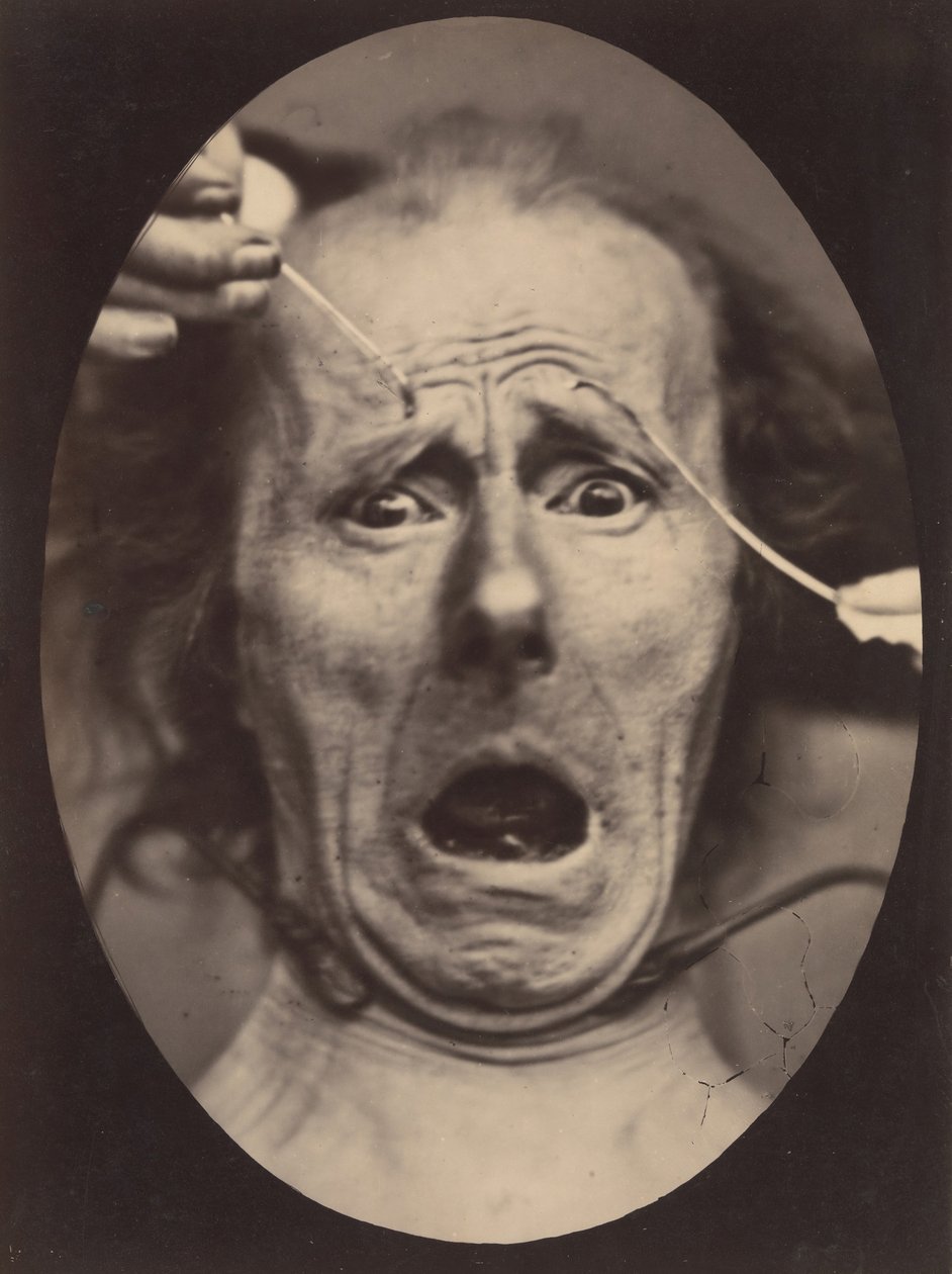 Electro-Fisiologia, Figura 64, 1854-56, impresso em 1862. de Adrien Alban Tournachon