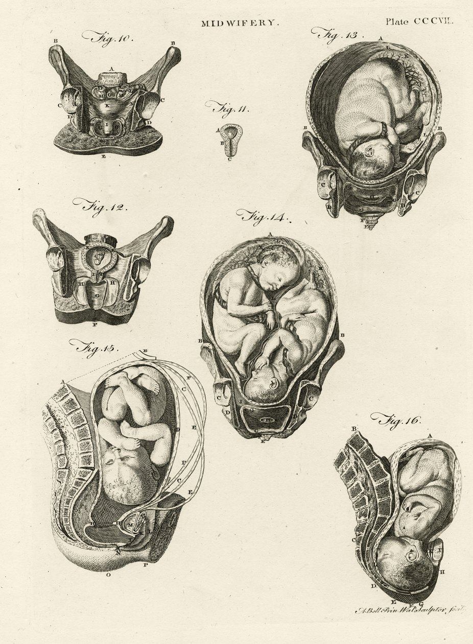 Obstetrícia, ilustração de &39;Encyclopedia Britannica&39;, publicada em Edimburgo, 1798 (gravura em chapa de cobre) de Alexander Bell
