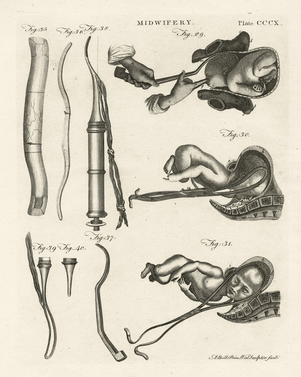 Obstetrícia, ilustração de &39;Encyclopedia Britannica&39;, publicada em Edimburgo, 1798 (gravura em chapa de cobre) de Alexander Bell