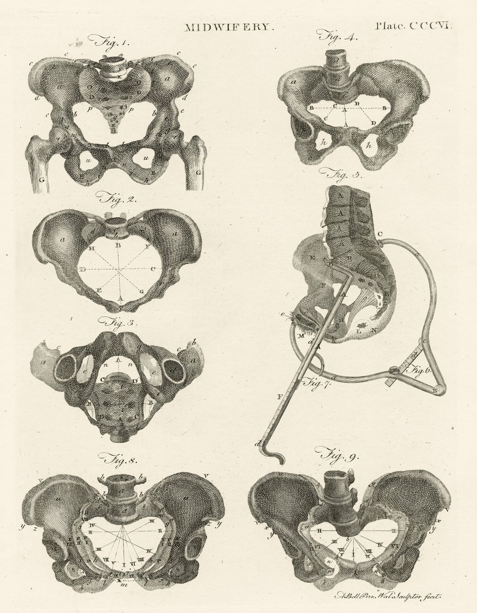 Obstetrícia, ilustração de &39;Encyclopedia Britannica&39;, publicada em Edimburgo, 1798 (gravura em chapa de cobre) de Alexander Bell