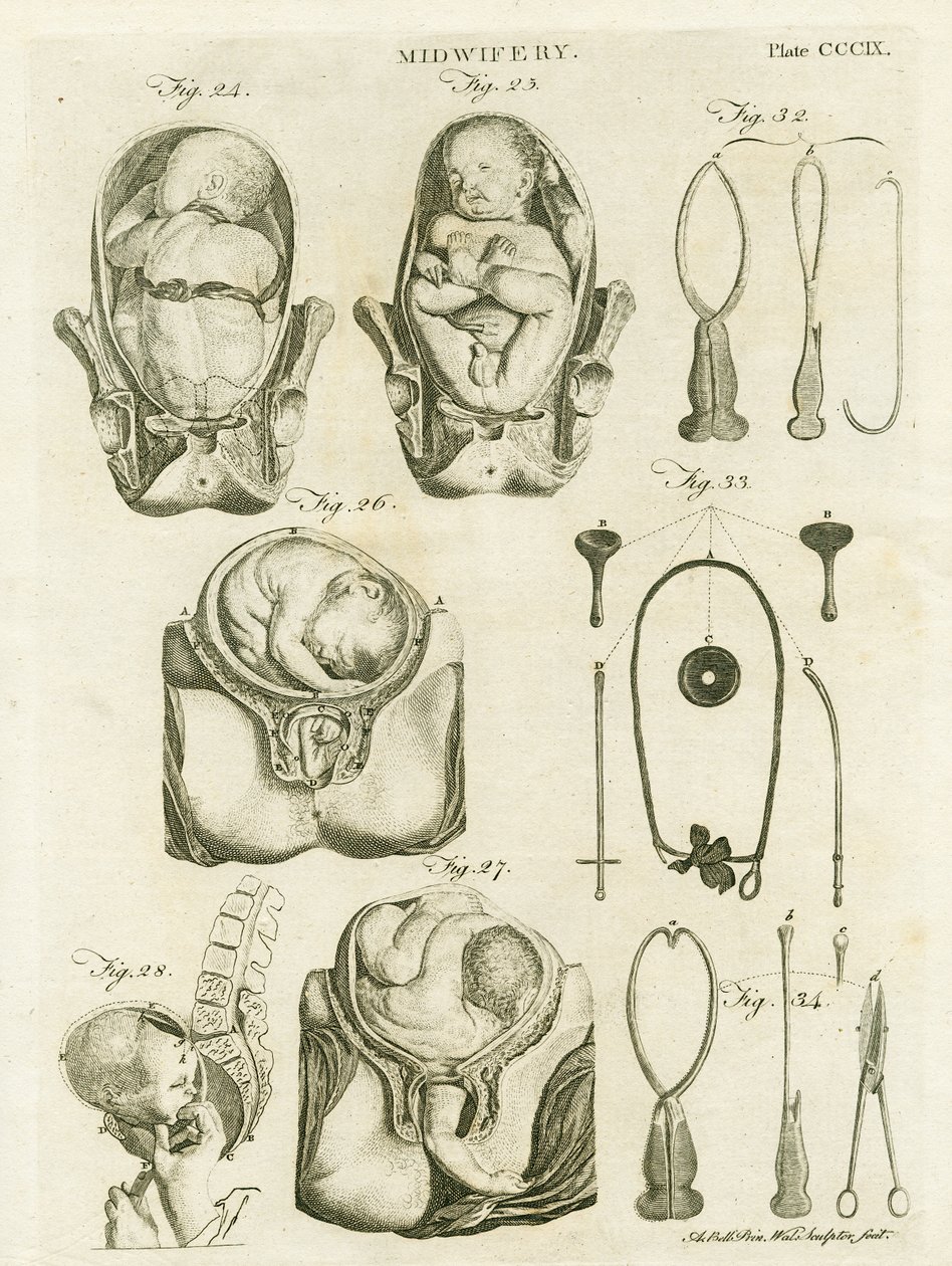 Obstetrícia, ilustração de &39;Encyclopedia Britannica&39;, publicada em Edimburgo, 1798 (gravura em chapa de cobre) de Alexander Bell