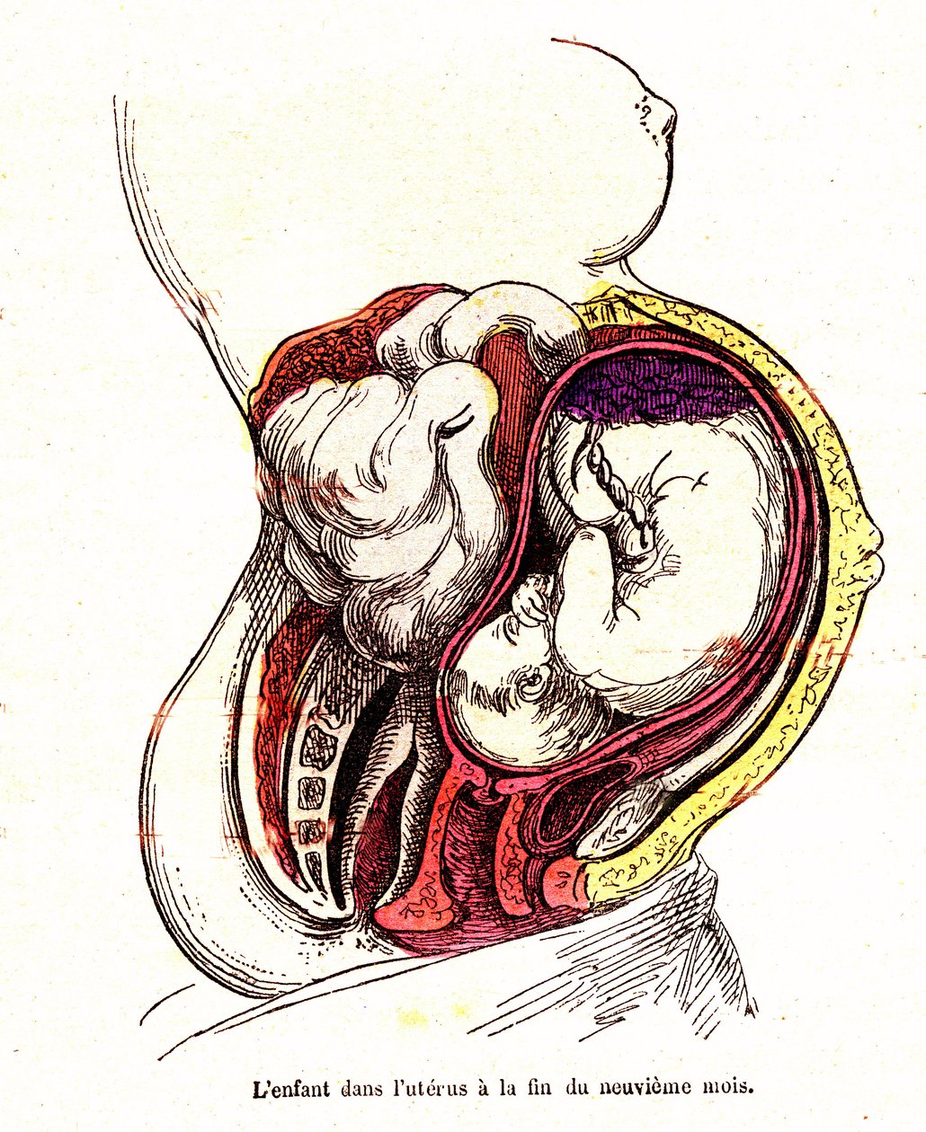 A criança no útero (fim do 9º mês) - A vida normal e a saúde de J. Rengade - Desenho de A. Demarle 1881 de Alphonse Demarle