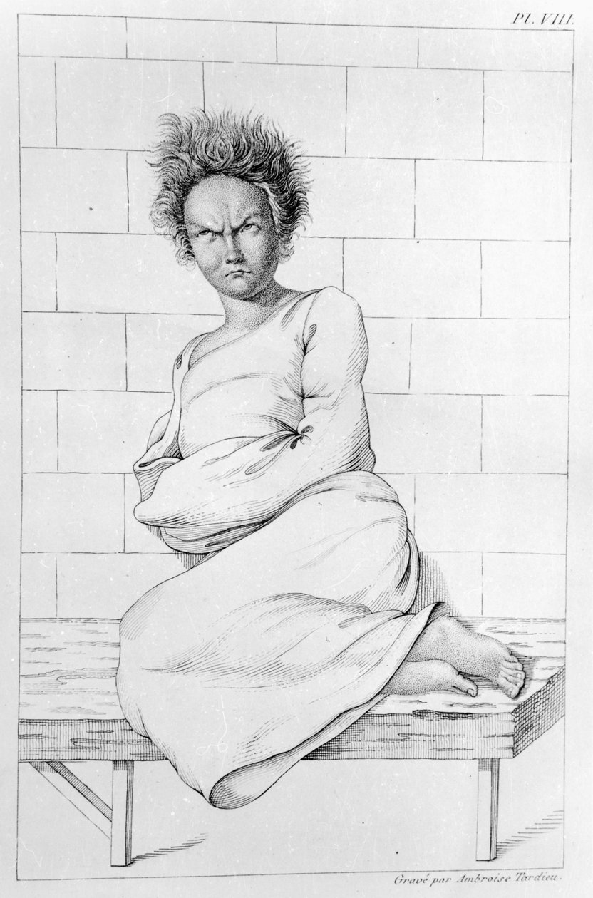 Mulher em uma camisa de força, ilustração para &39;doenças mentais consideradas médica, higiene e Medico-Legal&39;, por Etienne Esquirol (1772-1840), 1838 de Ambroise Tardieu