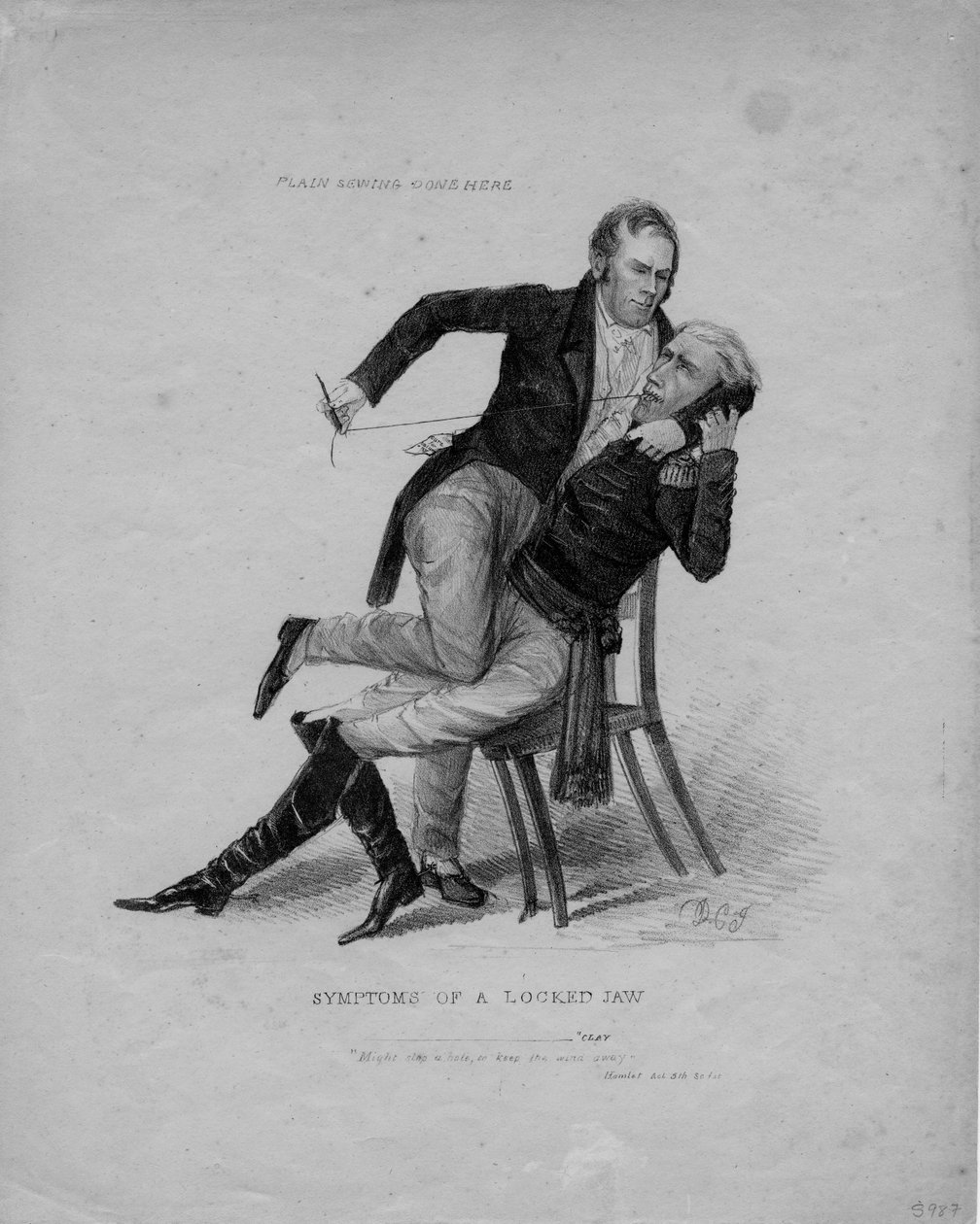 Sintomas de uma mandíbula bloqueada, c.1827 de American School