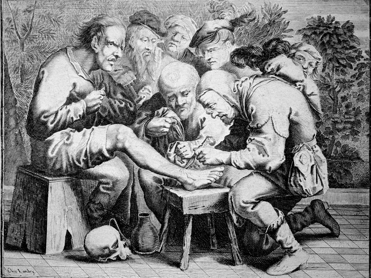 Cirurgia do tornozelo (gravura de Anonymous Anonymous