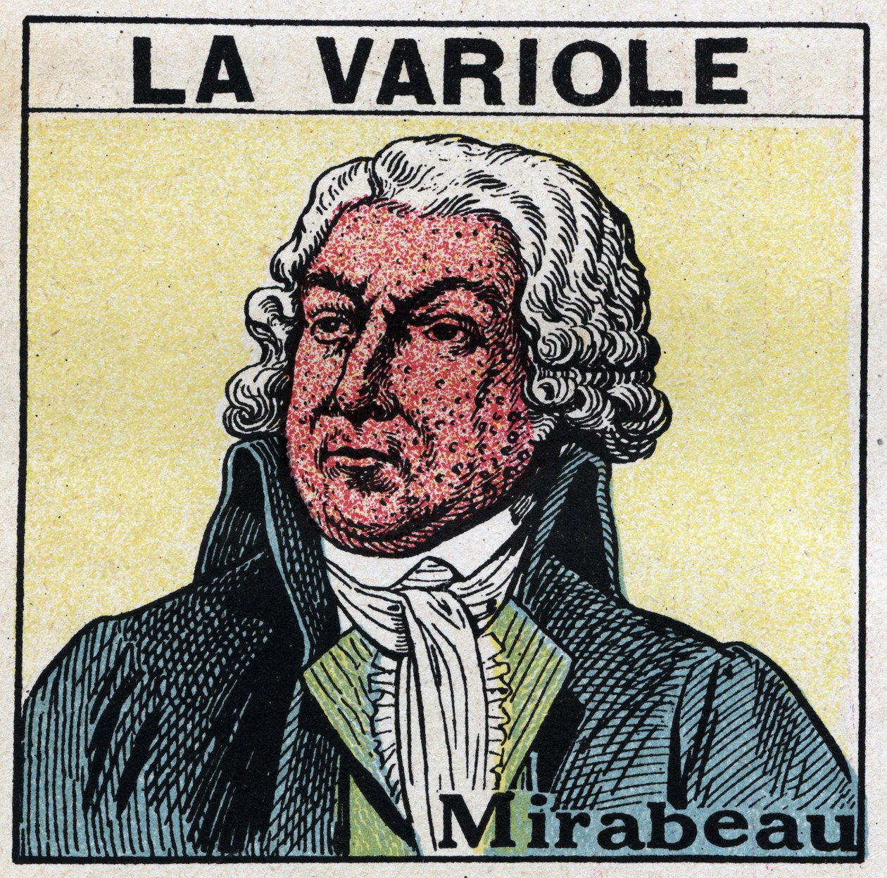 Retrato de Honore Gabriel (Honore-Gabriel) Riqueti, Conde de Mirabeau (1749-1791) com a face da figura por varíola. Para evitar cicatrizes causadas pela varíola, os pacientes devem ser tratados em quartos ou entrar apenas com luz vermelha, livre de raios u de Anonymous Anonymous