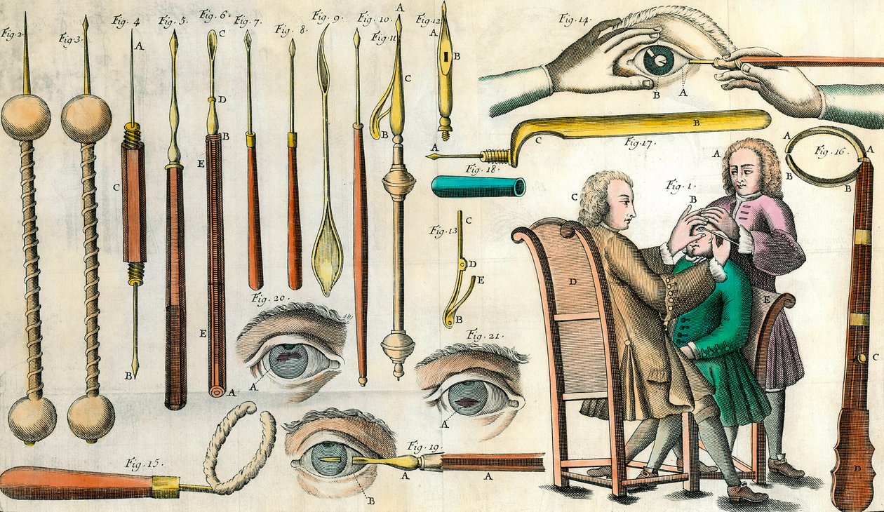 Cirurgia no século XVIII: operação aos olhos. Instrumentos para a operação de cataratas e formação de pupilas artificiais. Gravura em "Institutionis chirurgicae" de Lorenzo Heister de Anonymous Anonymous