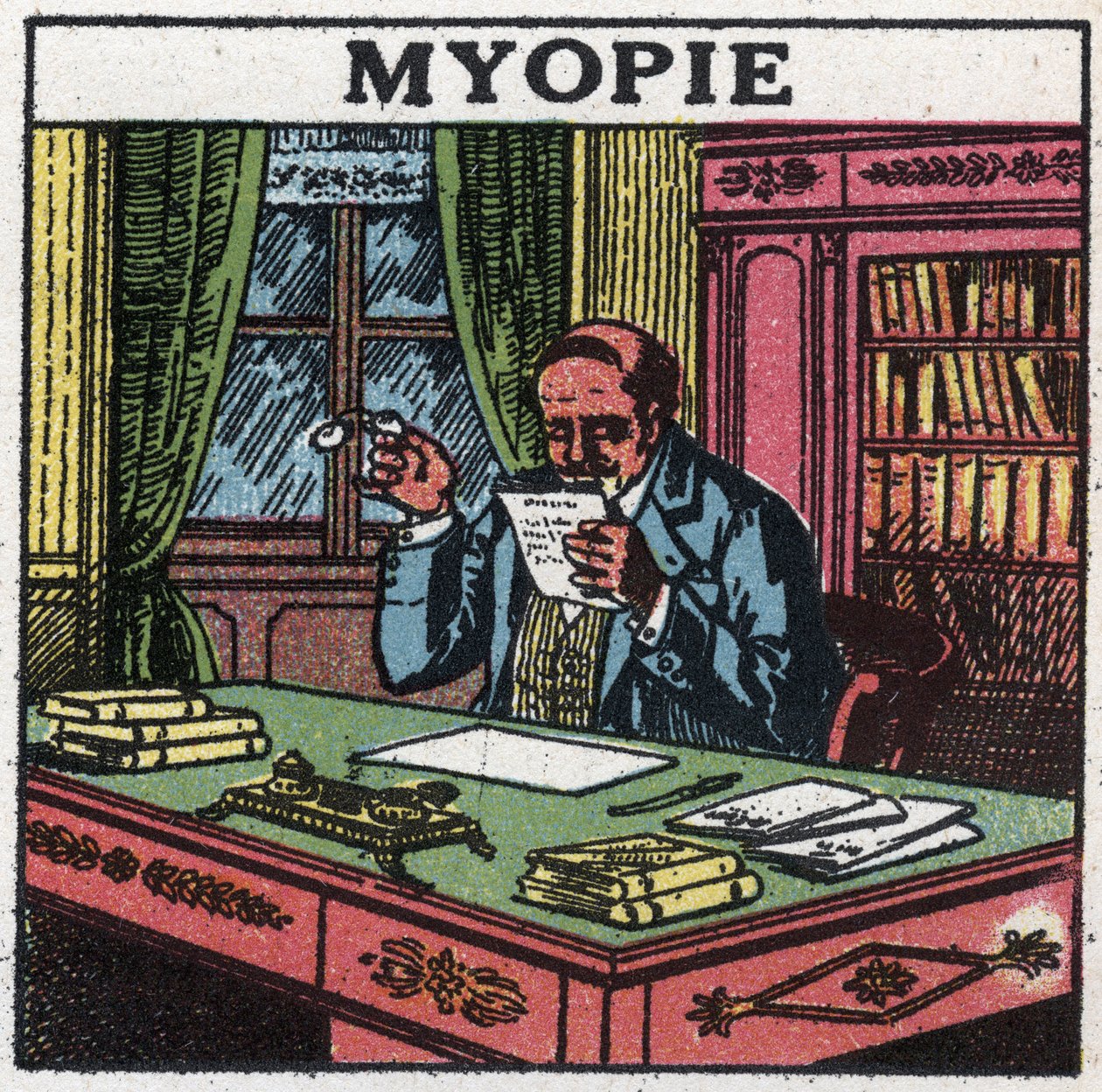 O olho: pessoa que sofre de miopia. Ilustração anónima de 1925. Colecção privada. de Anonymous Anonymous