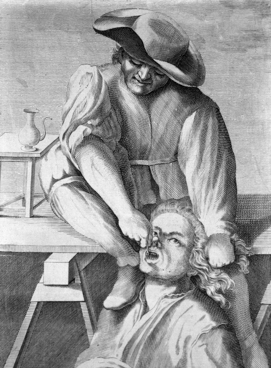 O puxador de dentes (gravura,século 18) de Anonymous Anonymous