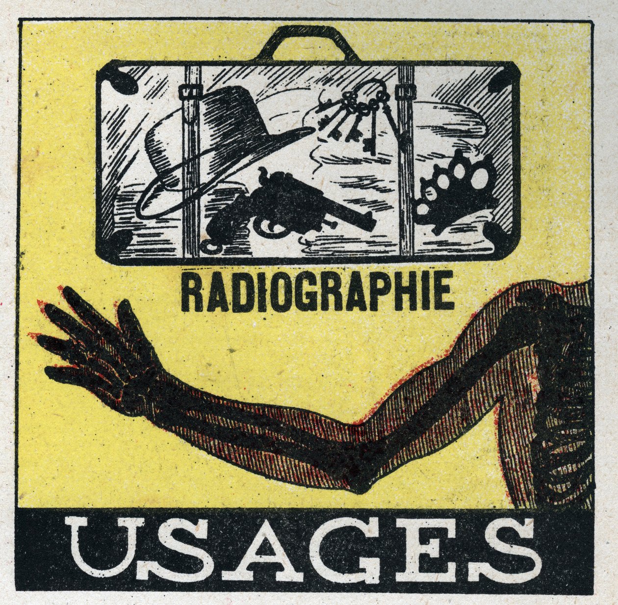 Raios-X: utilização de raios-X para ver através de objectos e corpos. Ilustração anónima a partir de 1925. Coleção privada. de Anonymous Anonymous