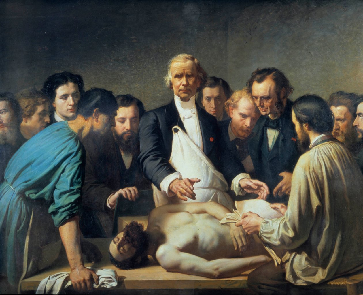 O Doutor Alfred Velleau (1795-1867) na Caridade vai proceder a uma autópsia Um médico rodeado pelos seus alunos que estão preparados para intervir num cadáver. Pintura de François Feyen Perrin (1826-1888). Século XIX. Tours musee des Beaux Arts - Alfred Ve de Auguste (after) Feyen Perrin