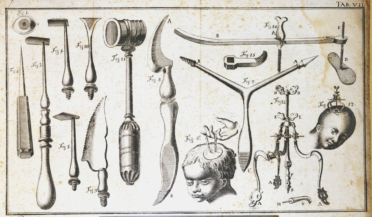 Quadro cirúrgico representando diferentes tipos de instrumentos cirúrgicos, martelo, vieira, facas, para a remoção do cérebro. Gravura de Benoit Louis Prevost (1735-1809) Século XVIII de Benoit Louis Prevost
