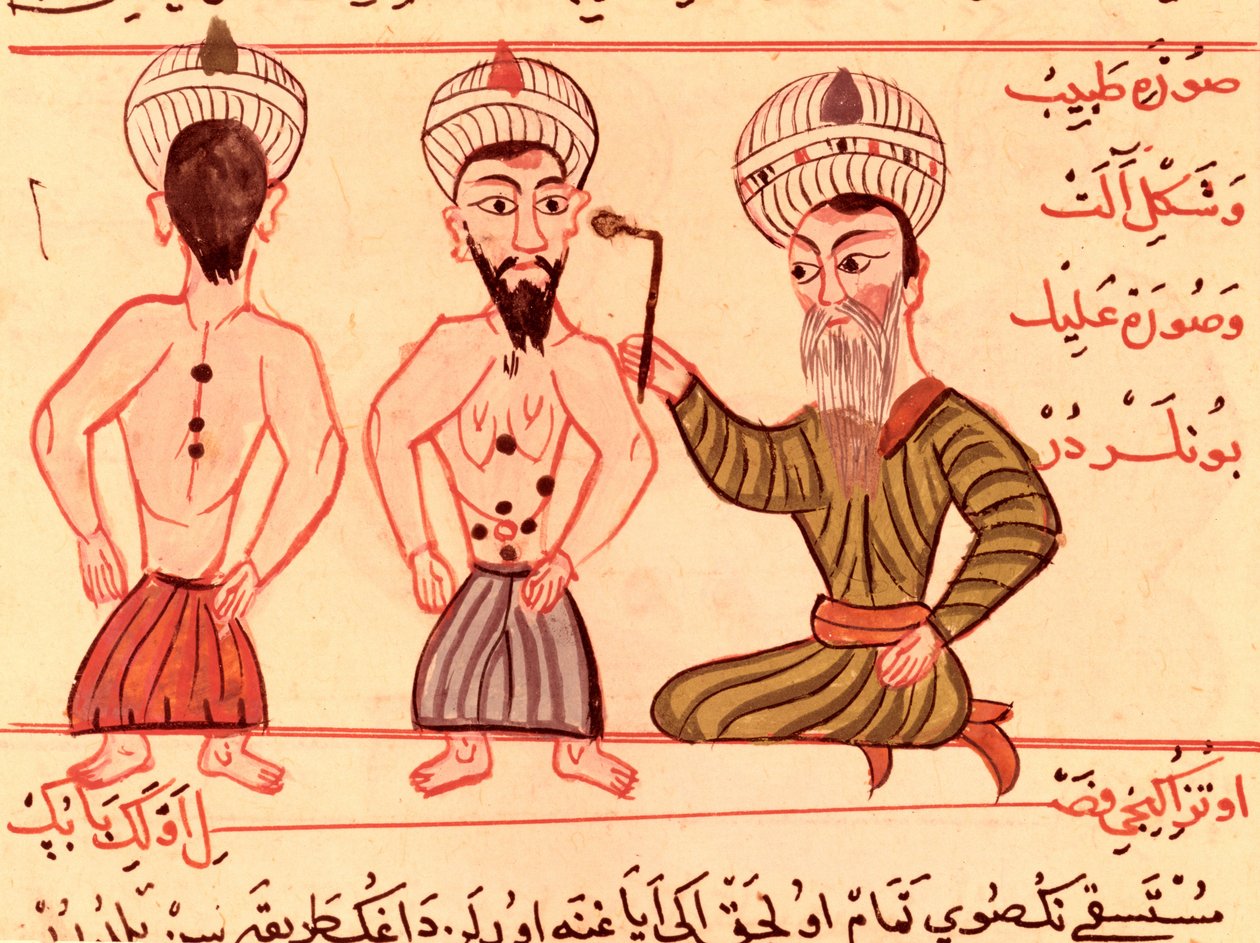 Sra. Tur Turc 693 fol.35 Operação para Cauterização, 1466 de Charaf ed Din