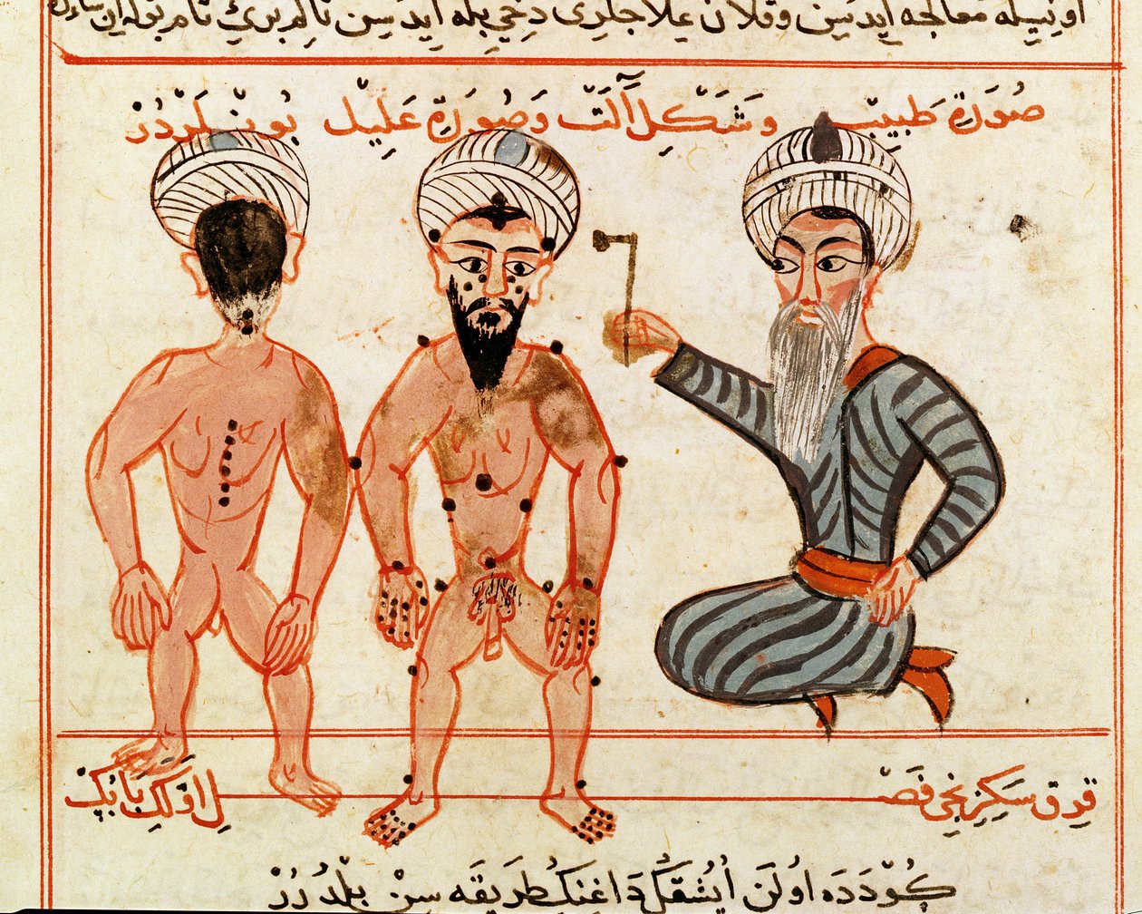 Ms Sup Turc 693 fol.46v Cauterização de lesões de lepra, 1466 de Charaf ed Din