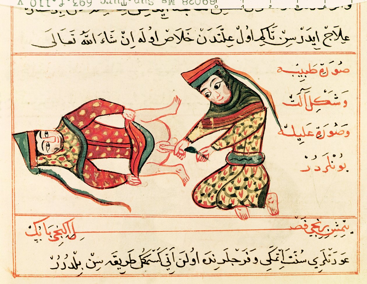 Sr. Sup Turc 693 fol.110v Parteira operando em um hermafrodita, 1466 de Charaf ed Din