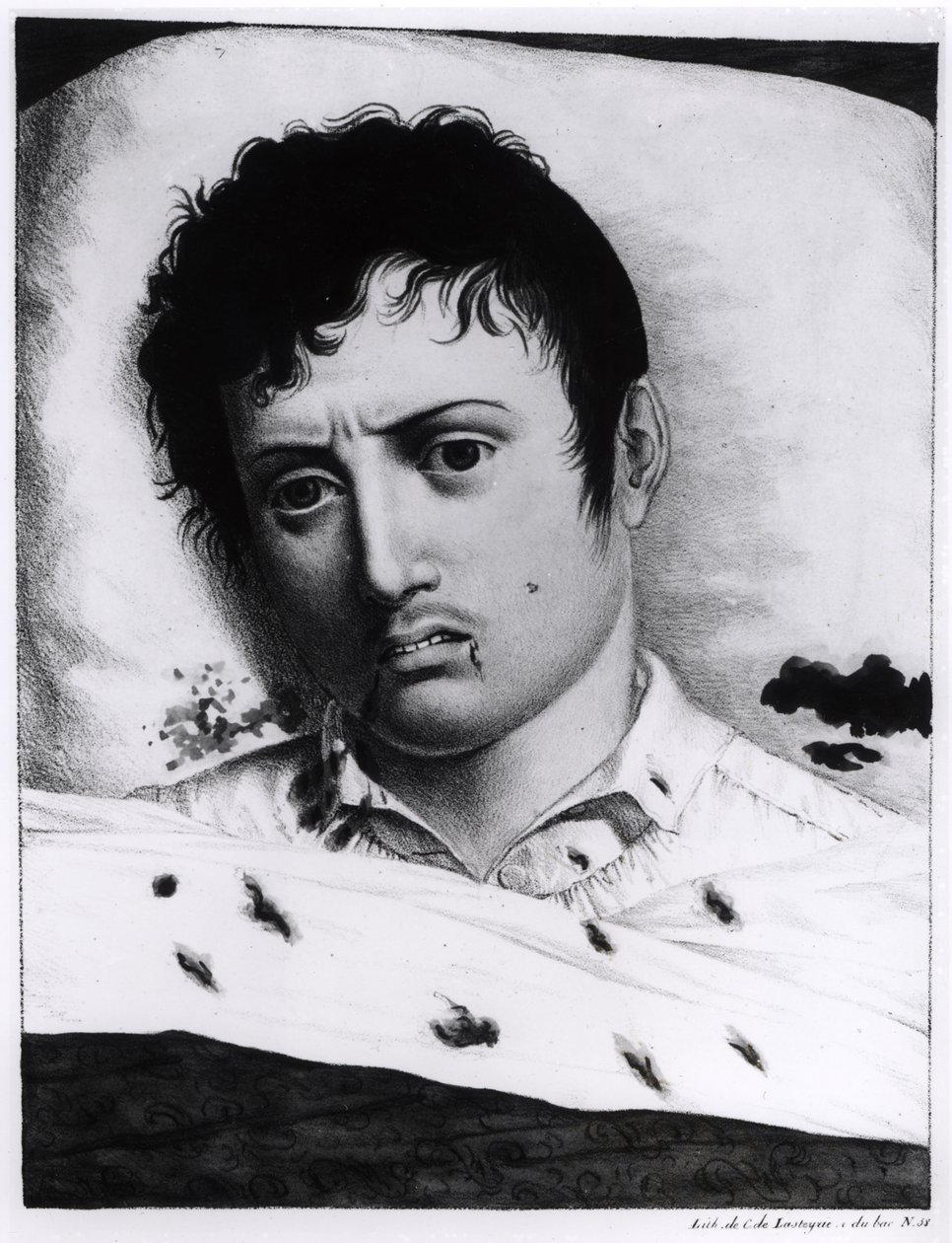Observação da Febre Amarela, c.1819 de Charles Lasteyrie du Saillant