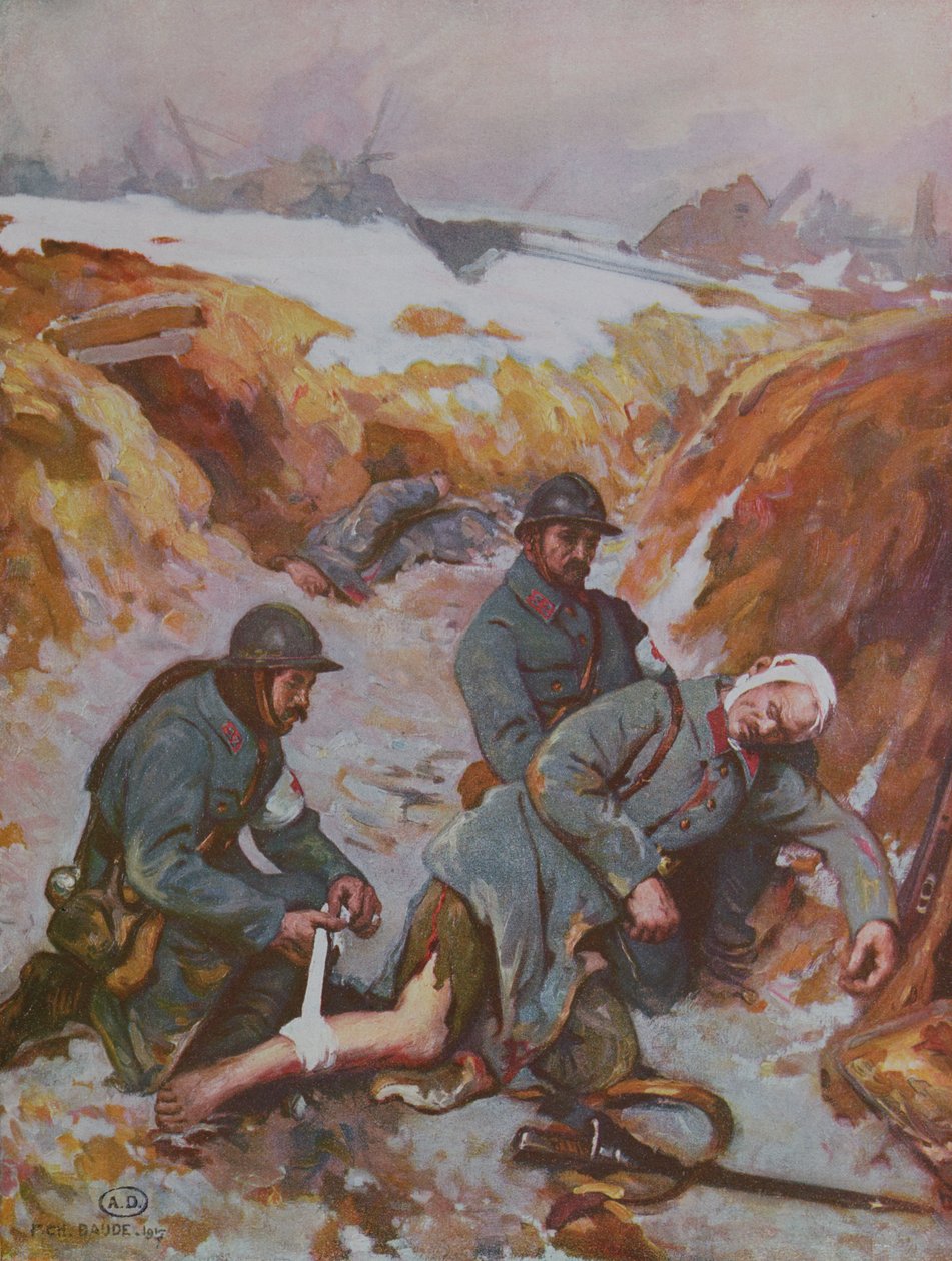 Enfermeira da Cruz Vermelha curando uma ferida durante a 1ª Guerra Mundial de Charles Baude