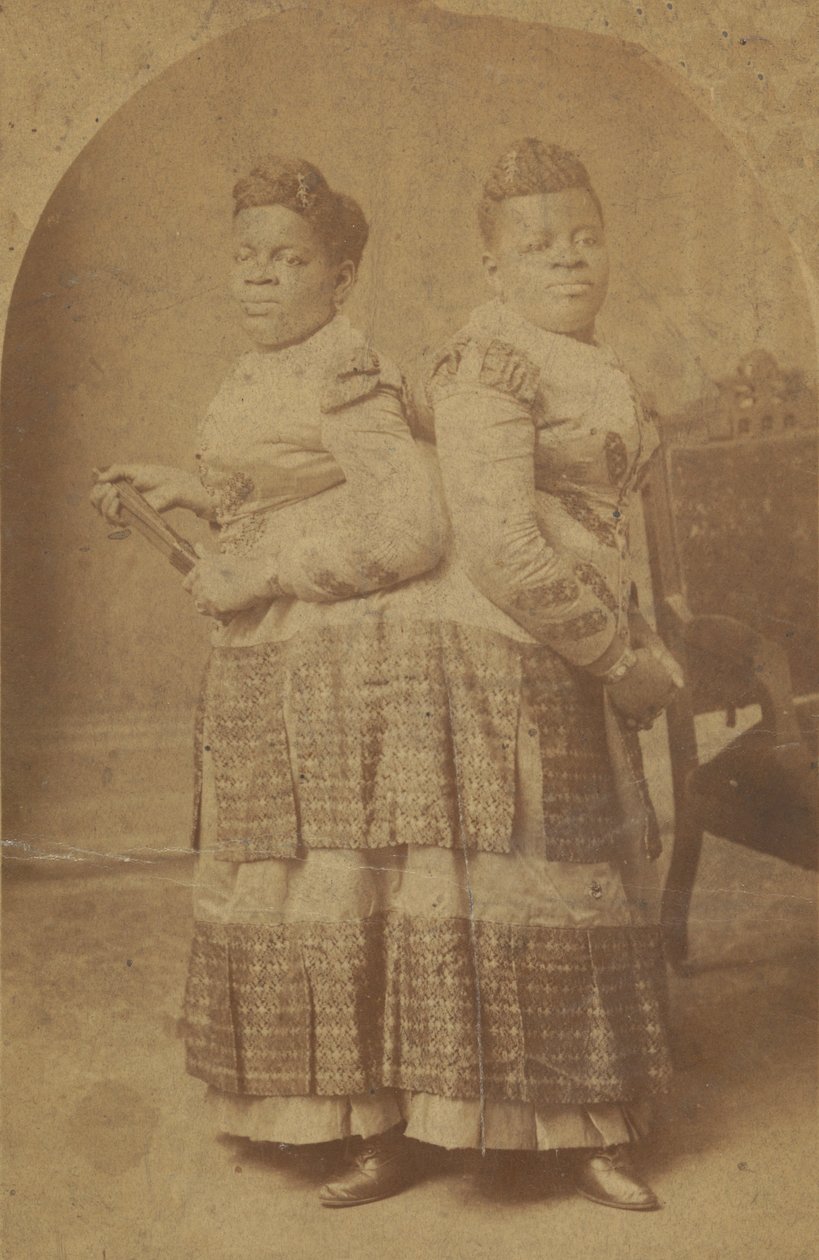 Impressão de albumina de Millie e Christine McCoy, 1880s -1890s. de Charles Eisenmann
