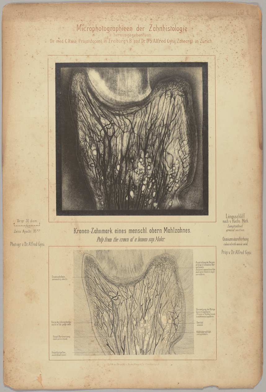 Polpa da coroa de um sup. molar humano de Dr. Alfred Gysi