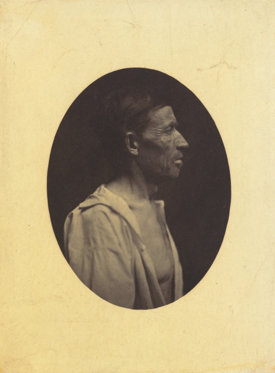Um retrato, visto de perfil, de um homem de 42 anos, estupefato pelo abuso do álcool..., 1854-1856. de Duchenne de Boulogne