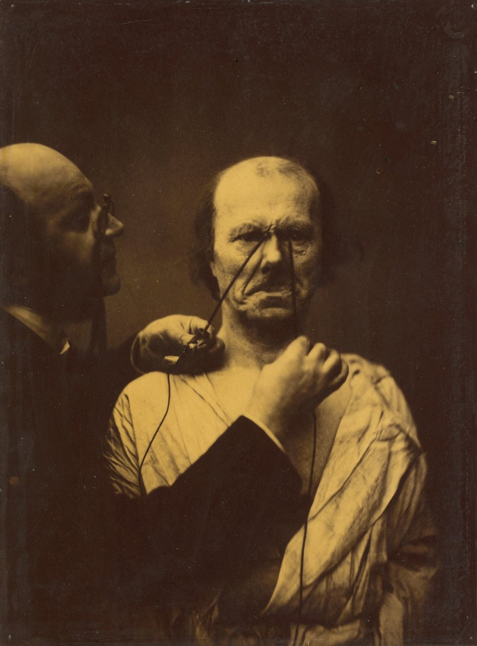 Agressão, maldade, 1854-1856, impresso em 1862. de Duchenne de Boulogne