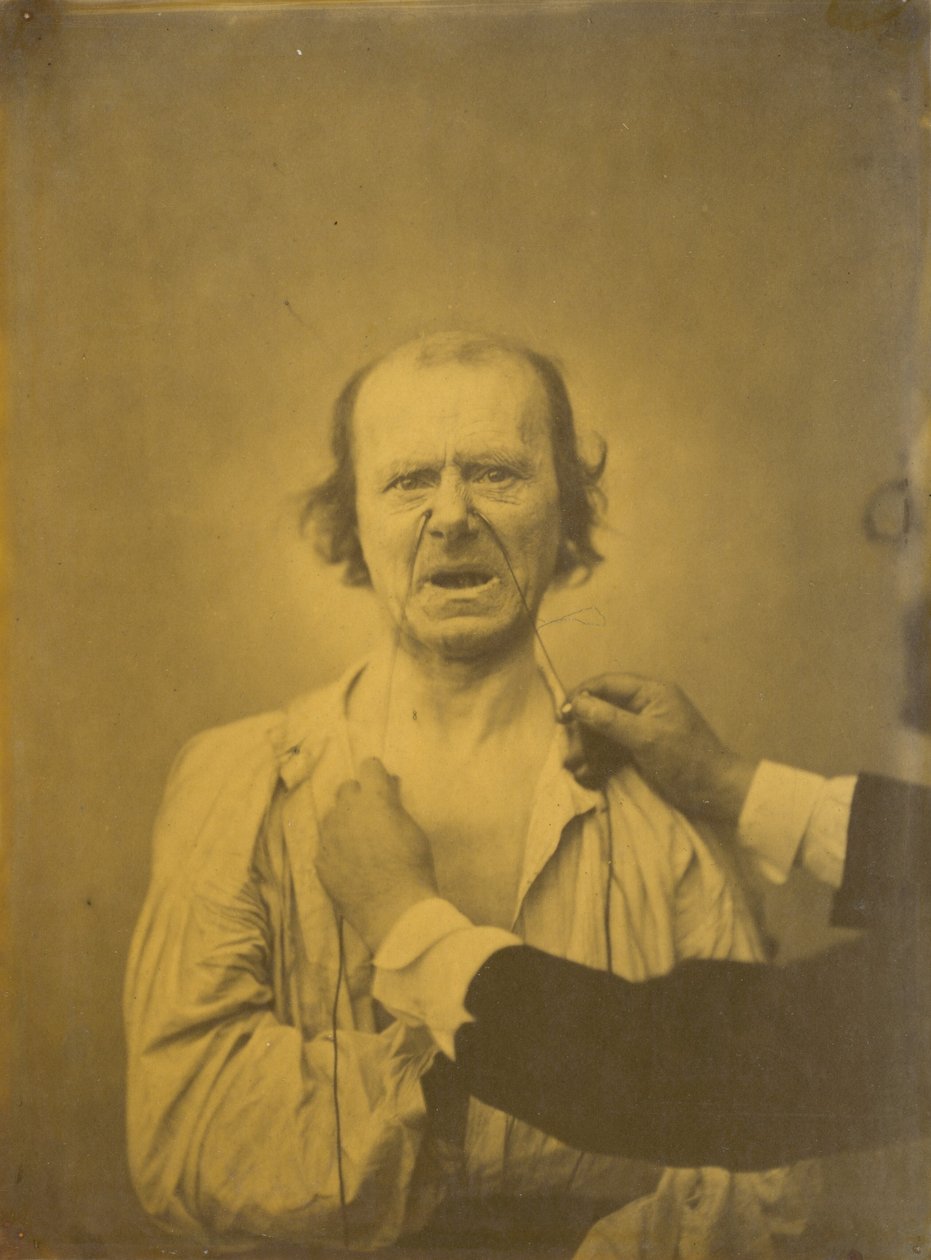 Descontente, mau humor, 1854-1856, impresso em 1862. de Duchenne de Boulogne