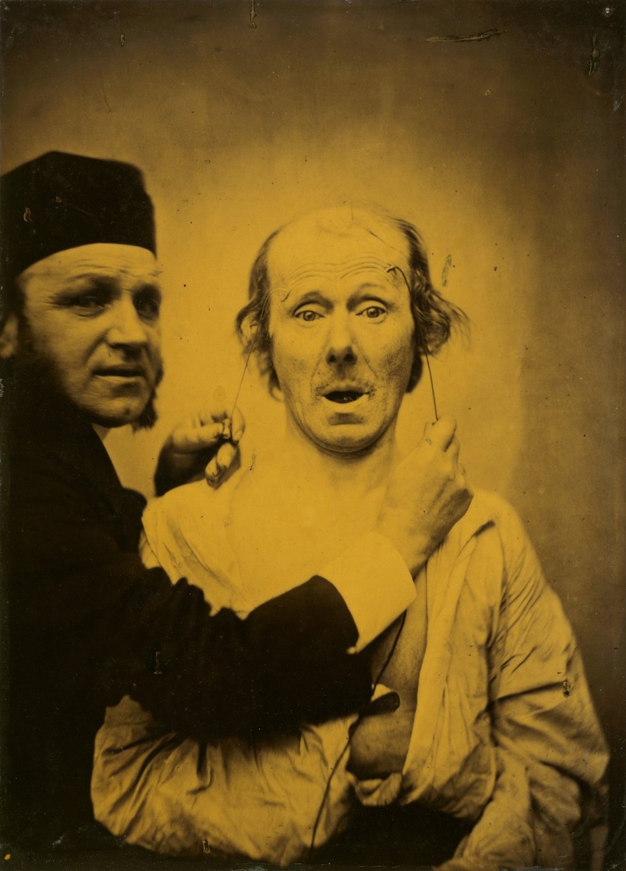 Surpresa, 1854-1855, impresso em 1862. de Duchenne de Boulogne