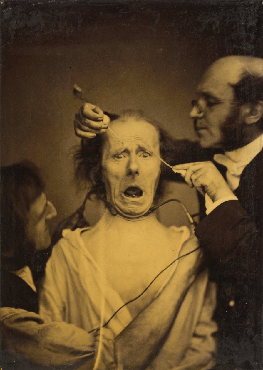 Terror misturado com dor, tortura, 1854-1856, impresso em 1862. de Duchenne de Boulogne