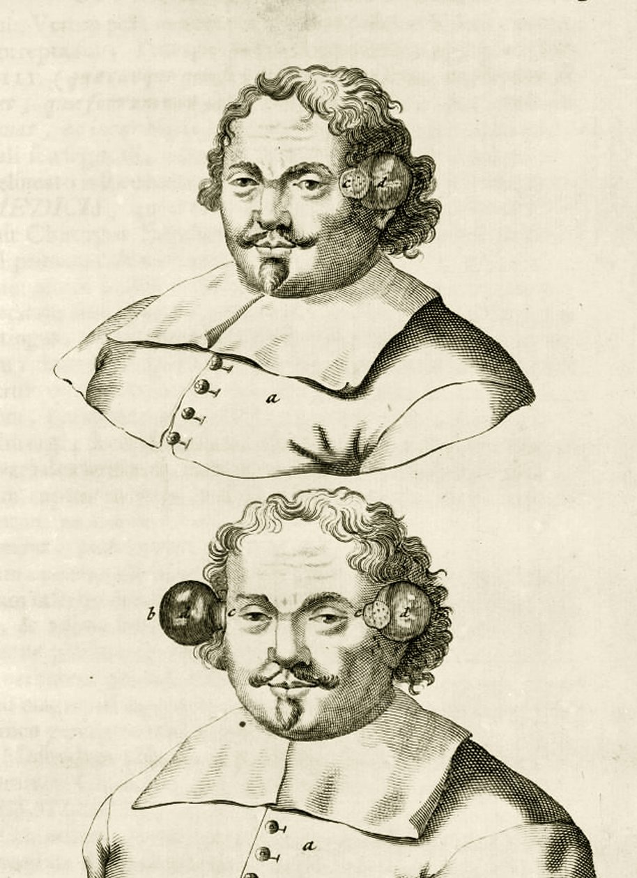 Um exemplo de escavação, a partir dos exercícios práticos para curar método por Frederic Dekkers, 1694 de Dutch School