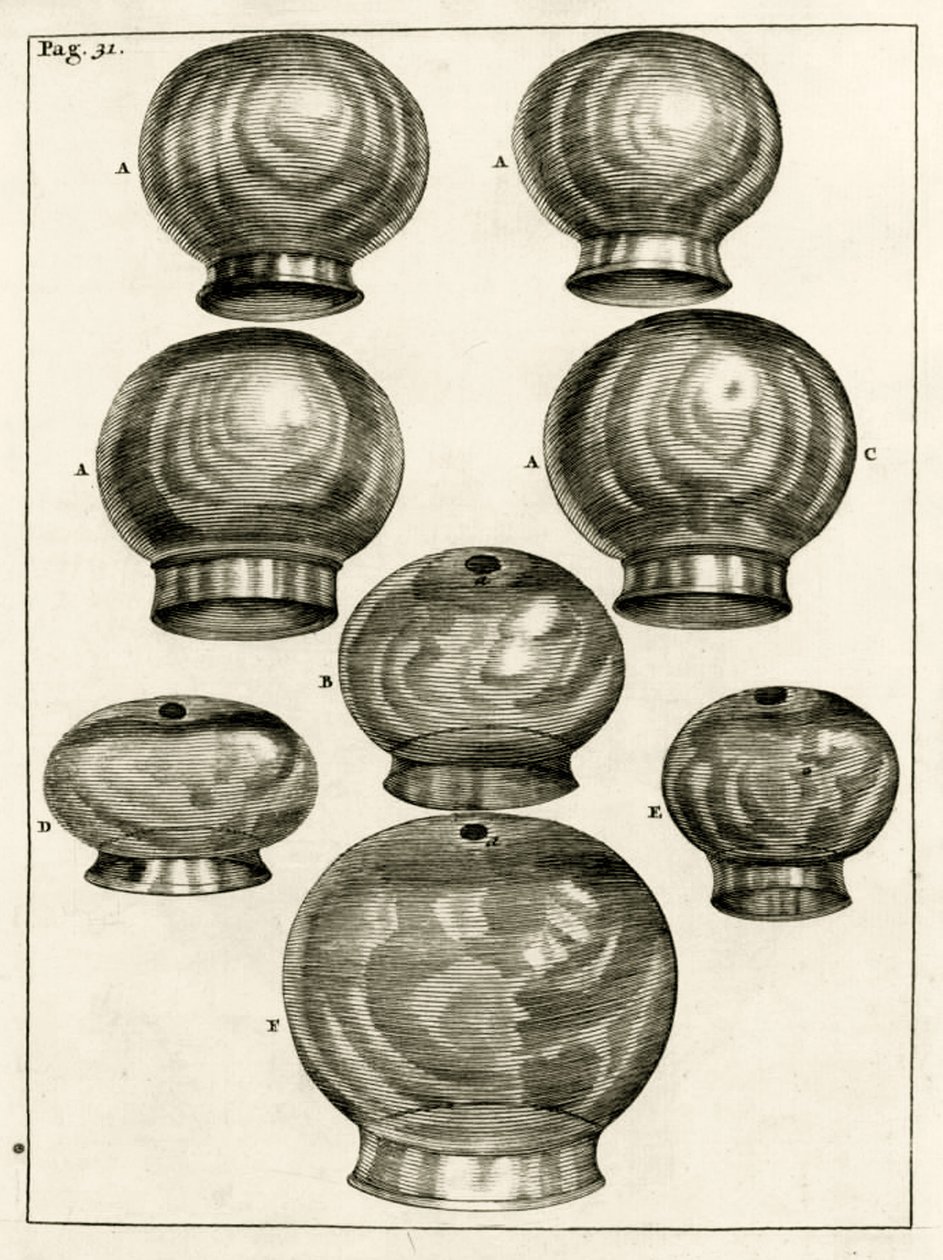Vários ventosas, desde os exercícios práticos para curar método pelo Frederic Dekkers, 1694 de Dutch School
