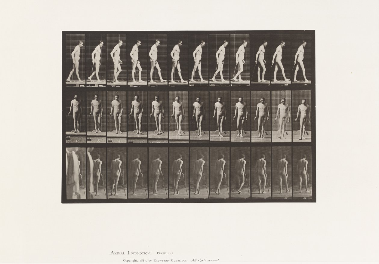 Prato 559. Esclerose disseminada; Caminhando com Cana de Eadweard Muybridge