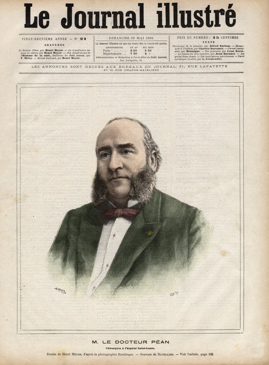 Retrato de Jules Emile (Jules-Emile) Pean (1830-1898), cirurgião francês - Gravura de Navellier em "The Illustrous Diary" de 1892 de Edouard Felicien Eugene Navellier