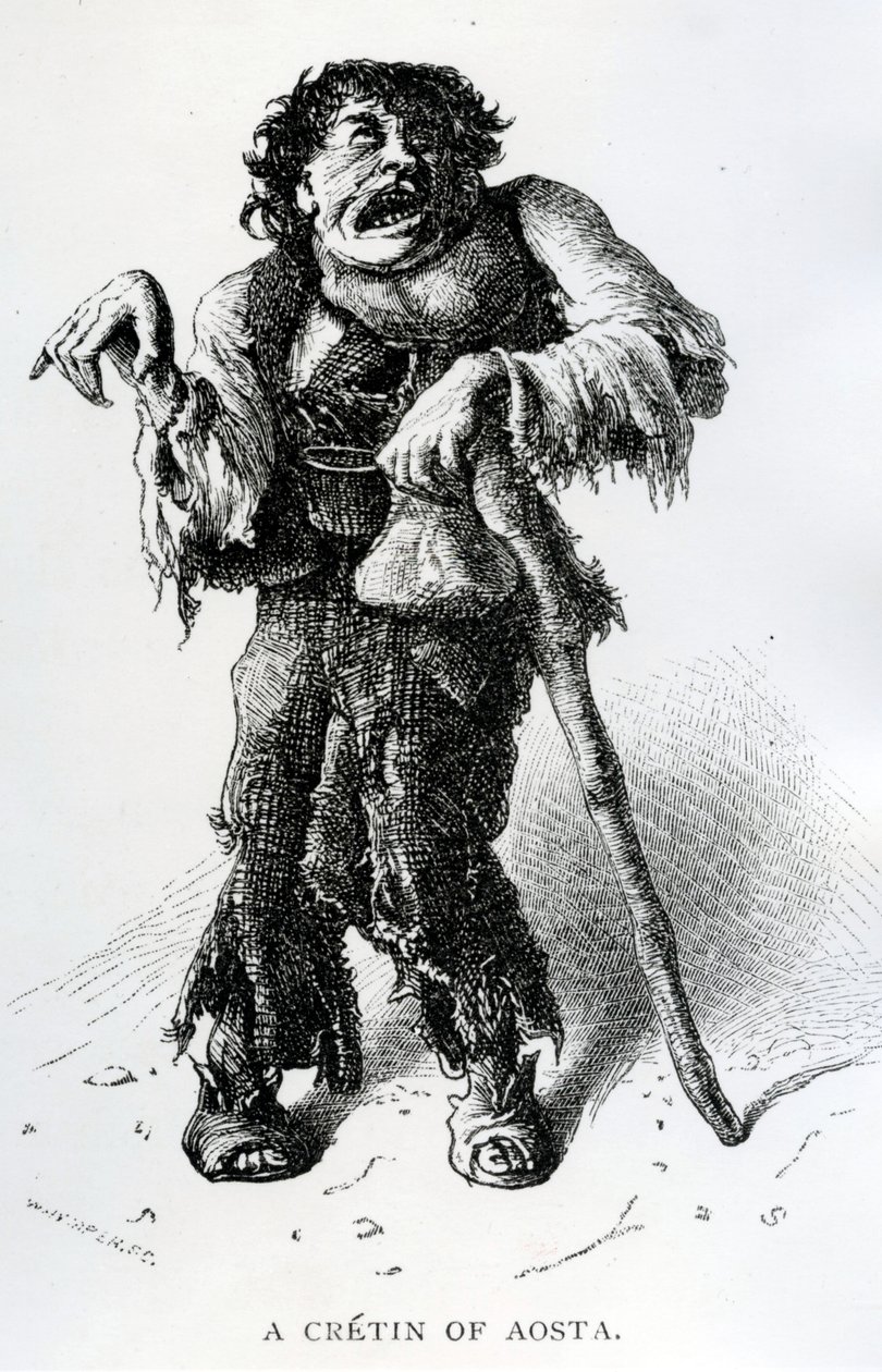 A Crétin de Aosta, c.1870 (gravura em madeira) de Edward Whymper