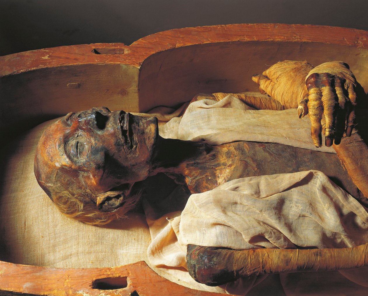 Múmia de Ramsés II (cerca de 1297-1213 a.C.), pormenor de Egyptian 19th Dynasty