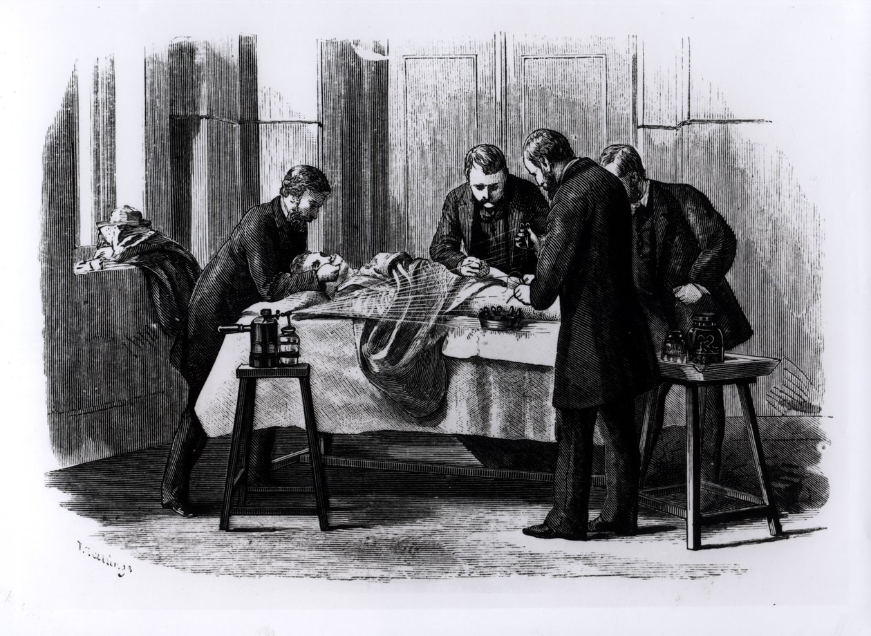 Cirurgia Anti-séptica, 1882 de English School