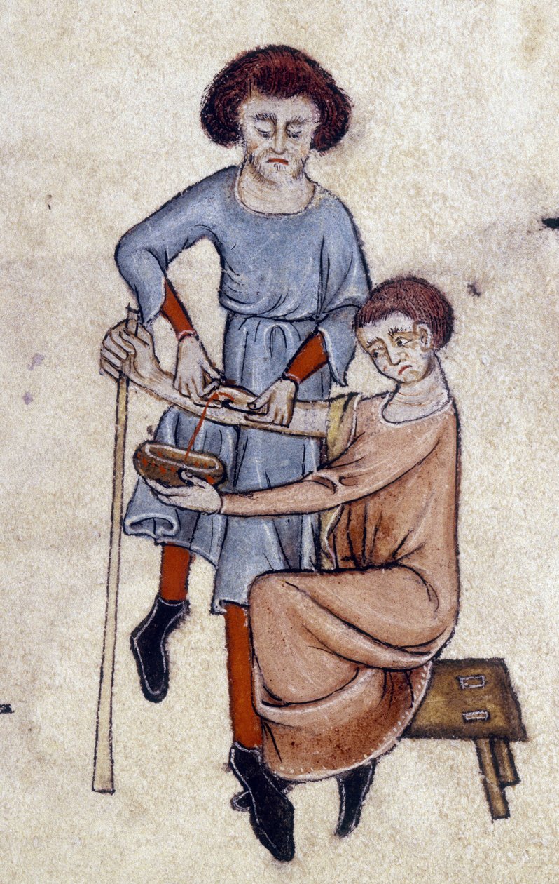 Blood Letting, do Luttrell Psalter, c.1325-35 (vellum) de English School