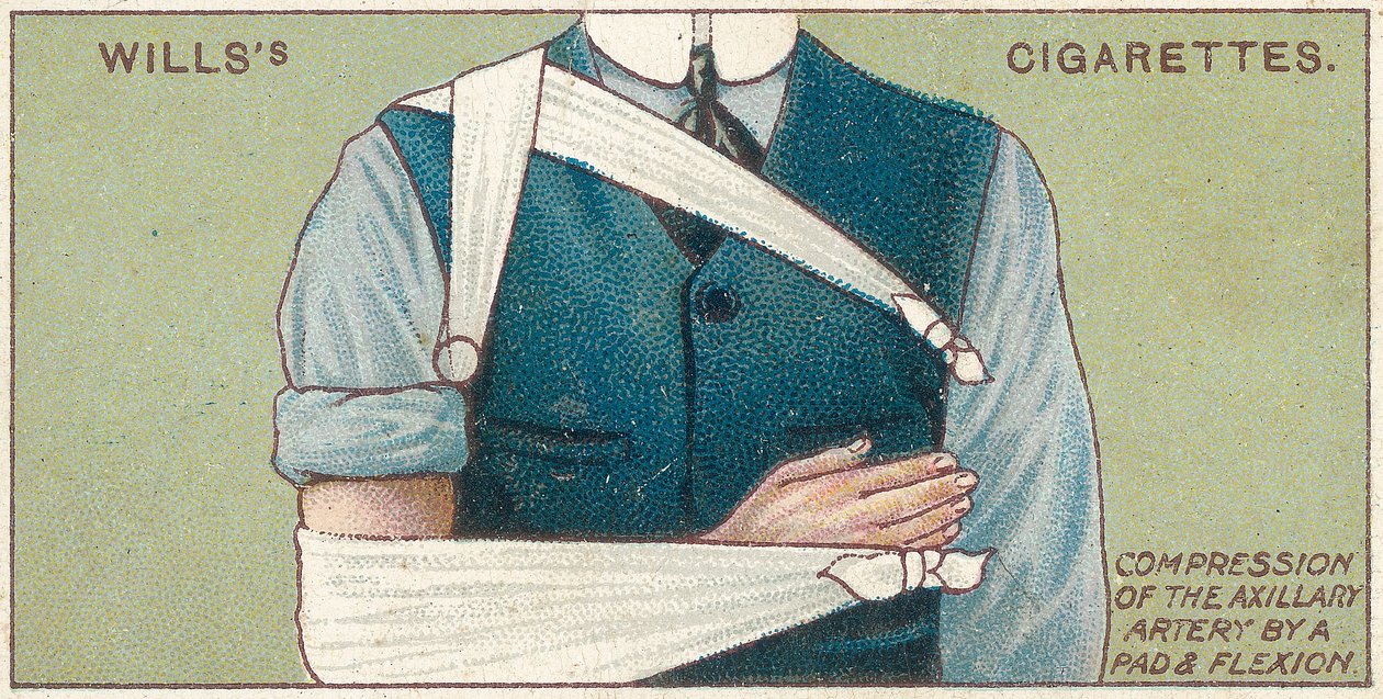Compressão da artéria auxiliar por uma almofada e flexão, no.41 da série de primeiros socorros de cartões de cigarros Willss, 1913 de English School