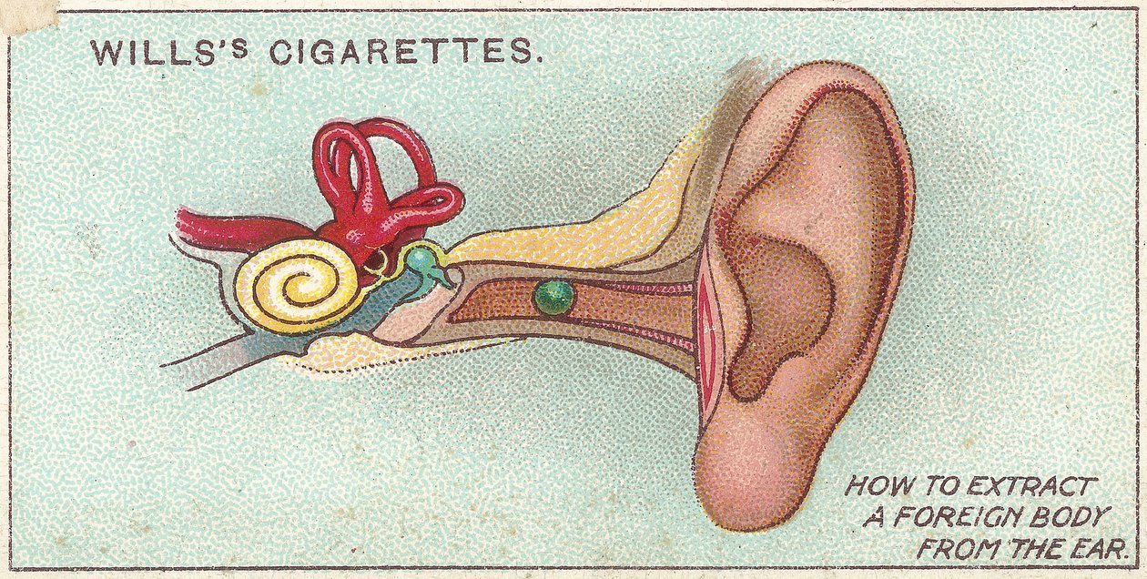 Corpo estranho em ouvido, não. 30 da série de primeiros socorros de cartões de cigarros Willss, 1913 de English School