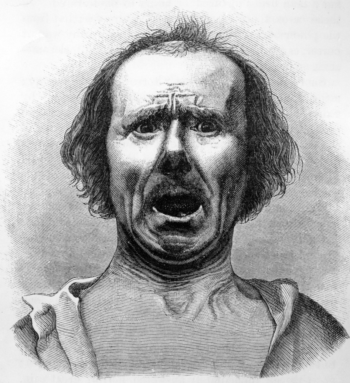 Horror and Agony, copiado de uma fotografia do Dr. Duchenne, ilustração de "A Expressão das Emoções no Homem e Animais", de Charles Darwin, publicado em 1872. de English School