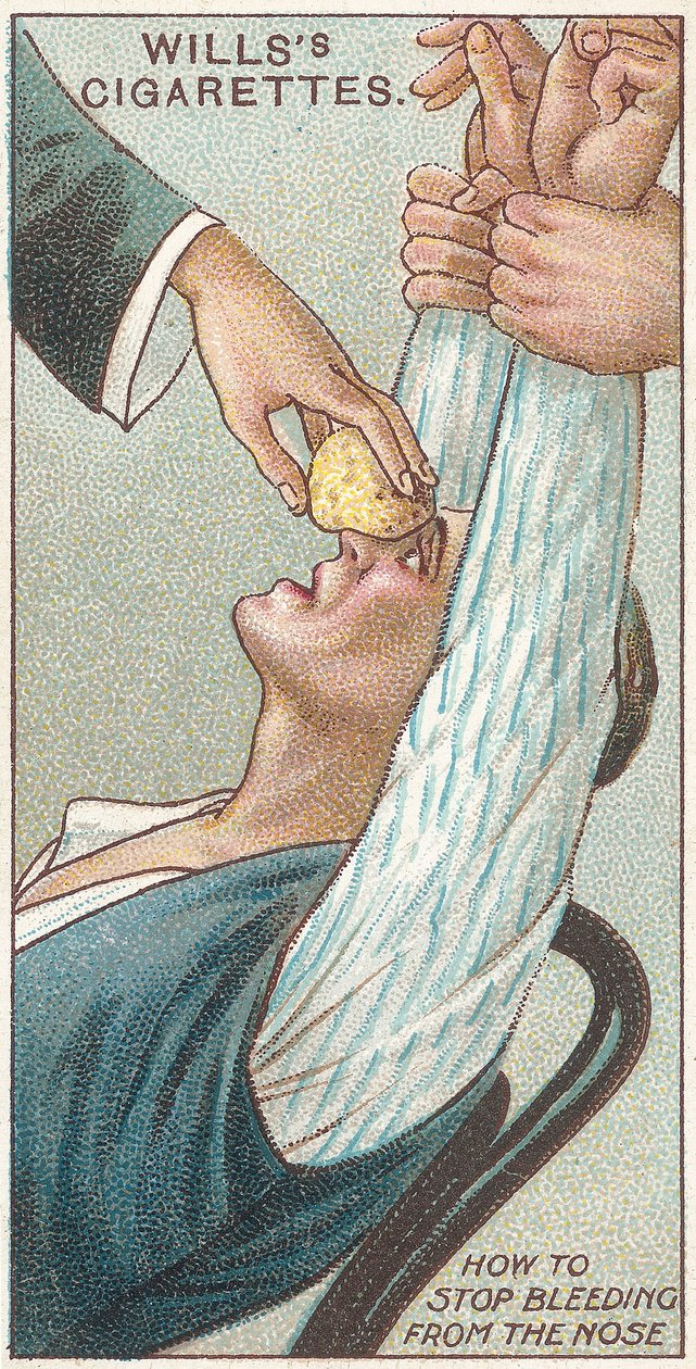 Como parar o sangramento do nariz, no.31 da série de primeiros socorros de cartões Willss cigarros, 1913 de English School