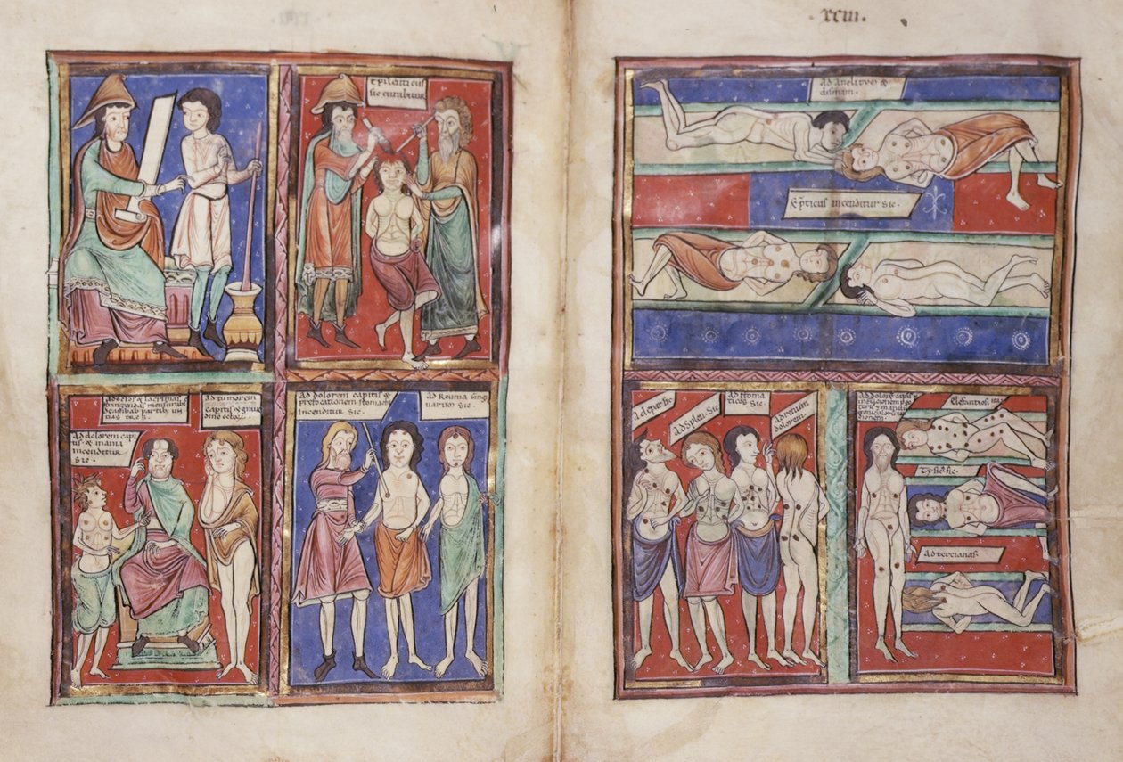 Sloane 1975 fol.91v-92 Cenas médicas de English School