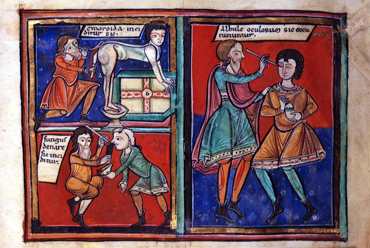 Sloane Sra. 1975 fol.93 Operações médicas de English School