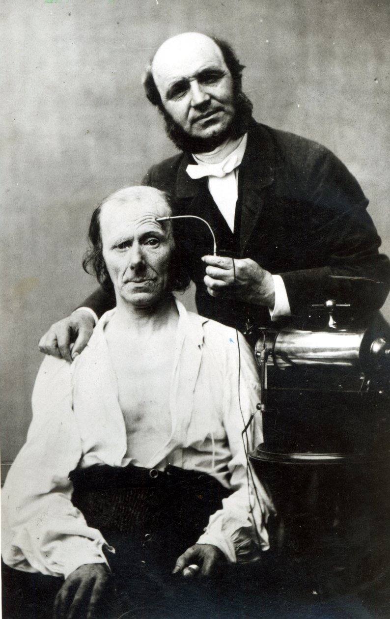 Duchenne de Boulogne com um paciente vítima, 1862 de French Photographer
