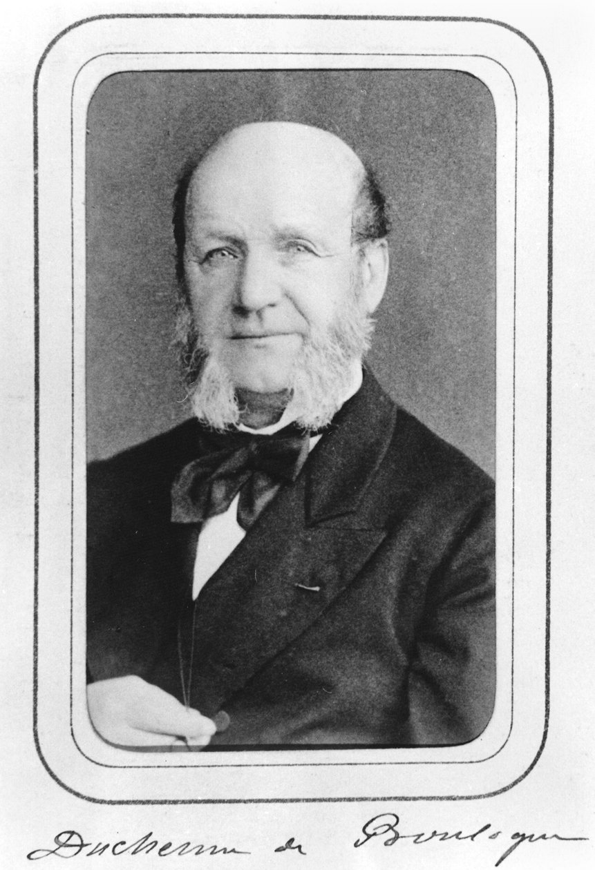 William Benjamin Duchenne de Boulogne (1806-75) de French Photographer