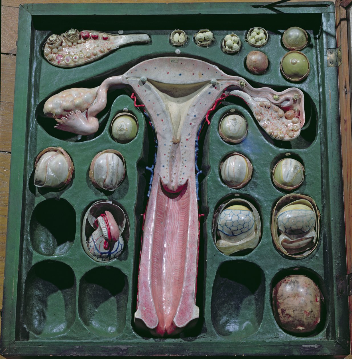 Genitais femininos, c. 1830 (papelão pintado) de French School