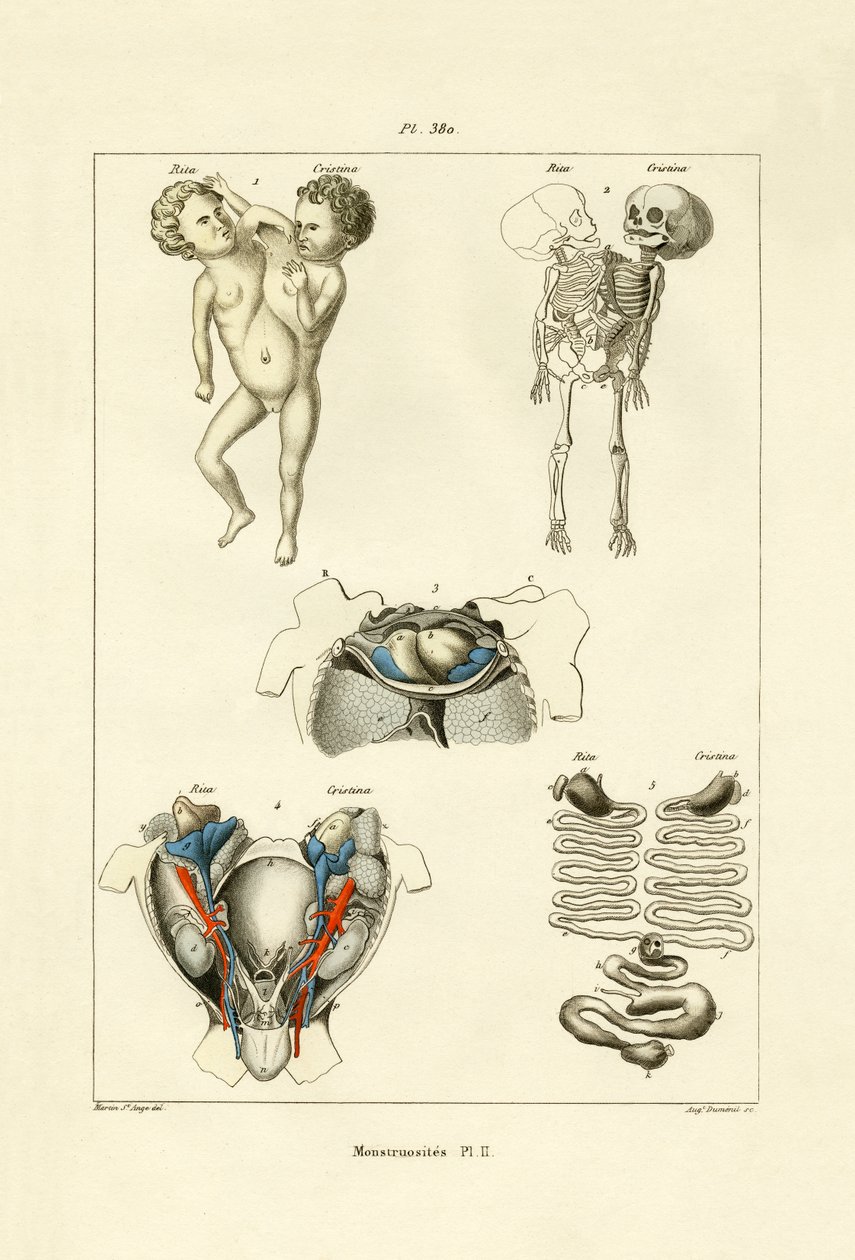 Anormal, 1833-39 de French School