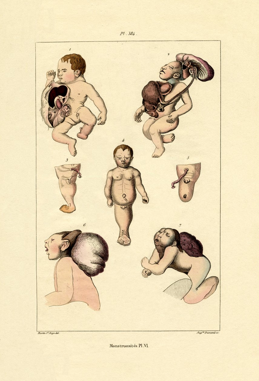 Anormal, 1833-39 de French School