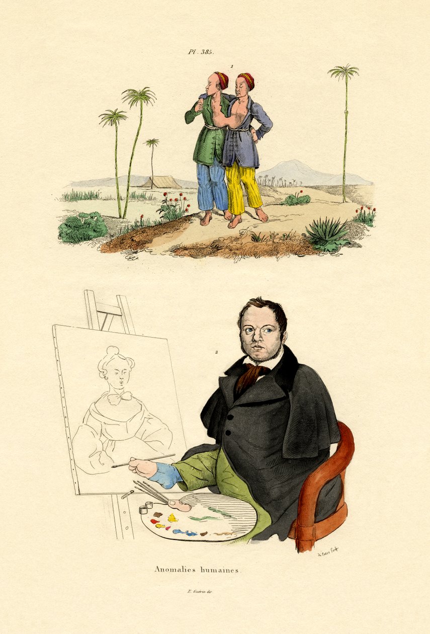 Anormal, 1833-39 de French School